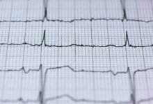 online expansion for pulse prism 6674006986